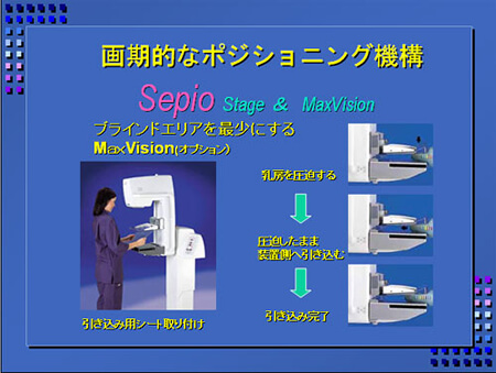 Ｘ線・マンモグラフィ